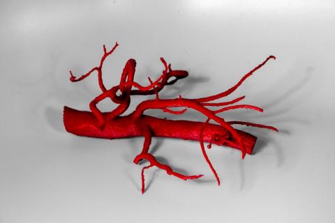 3D Print of an Abdominal Aorta and Its Major Branches