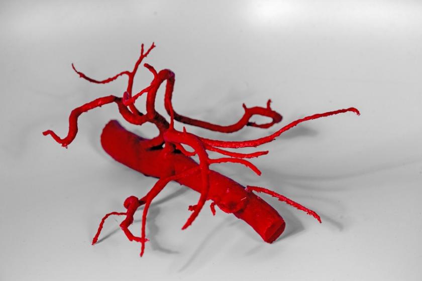 3D Print of an Abdominal Aorta and Its Major Branches